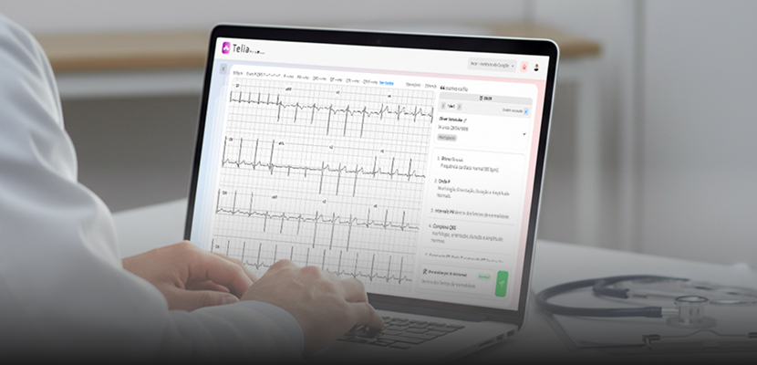 Plataforma Coreum by Micromed transformando o fluxo cardiológico em clínicas e hospitais com integração e inteligência artificial