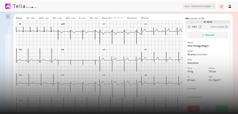 Interface da plataforma Coreum com laudos cardiológicos integrados por IA.